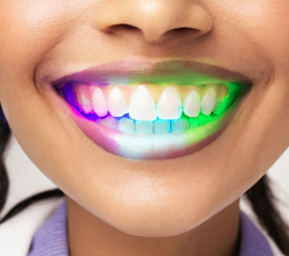 Dekoratyvinė LED dantų plokštelė